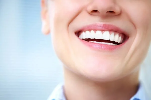 Bagaimana hukum bleaching dan veneer gigi dalam Islam? Simak penjelasan lengkap tentang pemutihan gigi, siwak, serta batasan syariat dalam mempercantik gigi. (Foto: Ilustrasi/iStockphoto)